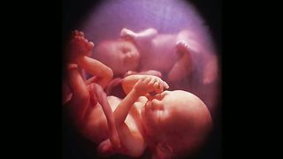 Светлана Копылова - Близнецы 2