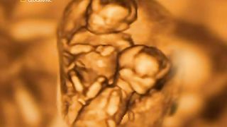 Жизнь До Рождения 1 - Близнецы