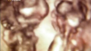 Жизнь До Рождения 4 - Однояйцевые близнецы