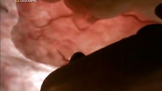 Жизнь До Рождения 4 - Однояйцевые близнецы