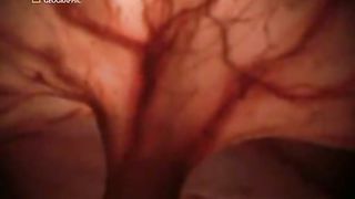 Жизнь До Рождения 5 - Собаки