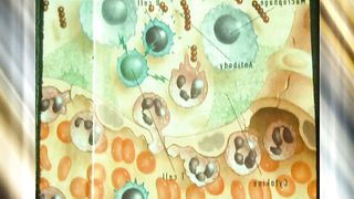 Эстер 21 Сила имунной системы