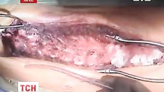 Спасем жизнь Оле Золотарь!