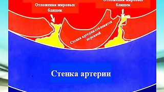 Курение - Слайд-шоу для курящих