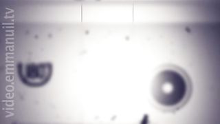 180 Градусов - Целебный разговор